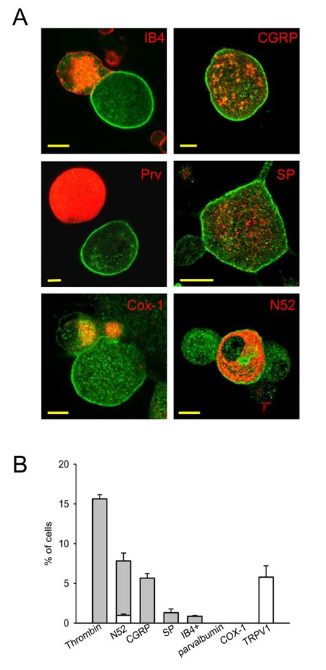 Co localisation of thrombin induced translocation of PKCε with other