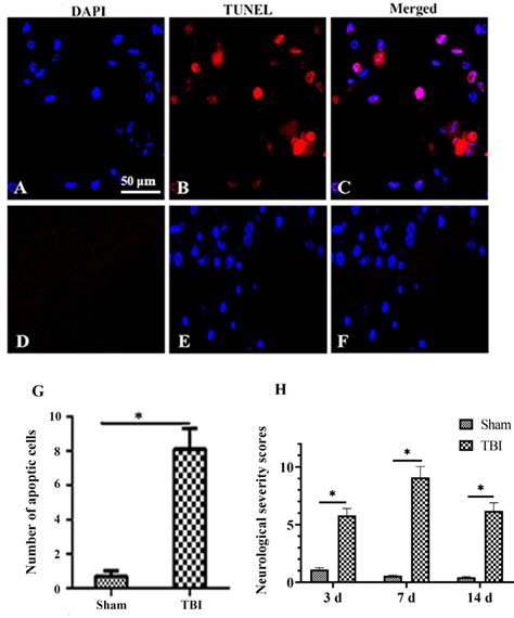 Neuronal apoptosis in TBI rats. A‐C and D‐F is to show the apoptosis ...
