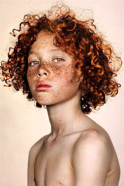 Amazing Portraits That Prove Freckles Are Beautiful