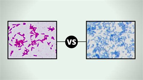 Difference Between Gram Positive And Gram Negative Bacteria Gram