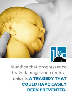 Jaundice That Leads to Cerebral Palsy Is Medical Negligence | JJS