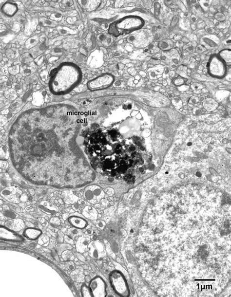 Chapter 14 Microglial Cells Fine Structure Of The Aging Brain