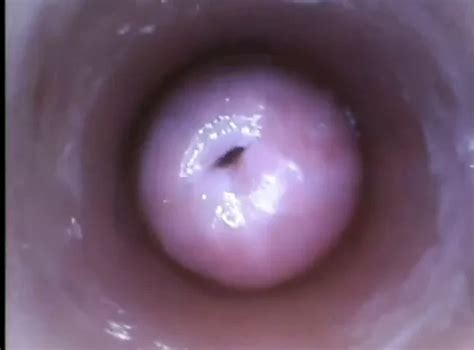 Vaginal Uterus And Intravaginal Ejaculation Pussy Porn Xhamster