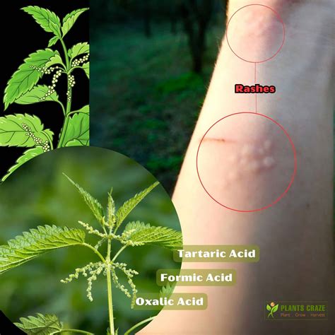 Stinging Nettle Root Vs Leaf: Big Differences To Know