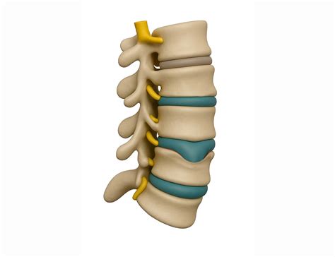 ERNIA DI SCHMORL: Come gestirla con la Fisioterapia