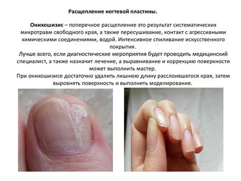 Наращивание ногтей на верхние формы - презентация онлайн