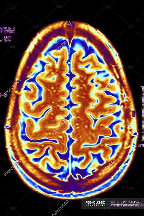 Magnetic Resonance Imaging Physical And Biological 7