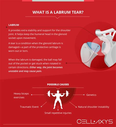 labrum tear cellaxys