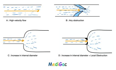 cardiac murmurs definition mechanisms grades types loudness medigac