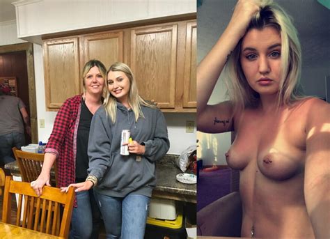 Before After Vol1 D Amt 0106 Porn Pic