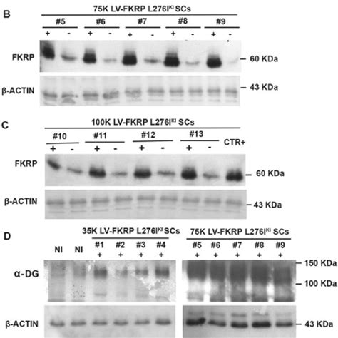 Exosomes characterization. Nanosight Tracking Analysis (NTA) of ... 