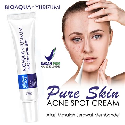 Jual Bpom Pure Skin Acne Spot Bioaqua X Yurizumi Krim Obat Jerawat