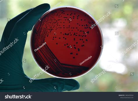 8개의 Colony Morphology Of Corynebacterium 이미지 스톡 사진 3d 오브젝트 벡터