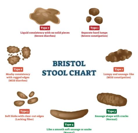 Yellow Balls in Stool: 6 Things You Should Never Ignore