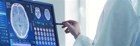 O que faz um Neurologista? Conheça as funções desse especialista!