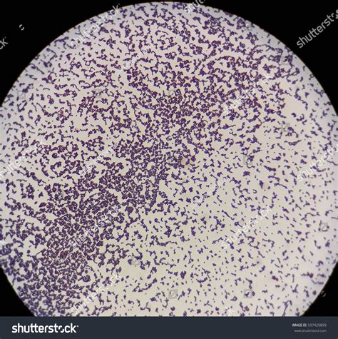 Smear Gram Positive Cocci Bacteria Under Stock Photo