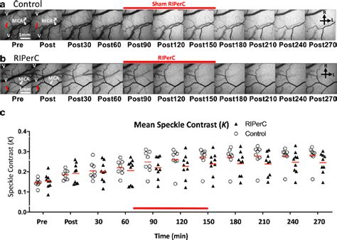 Laser speckle contrast imaging of collateral blood flow. (a-b ...