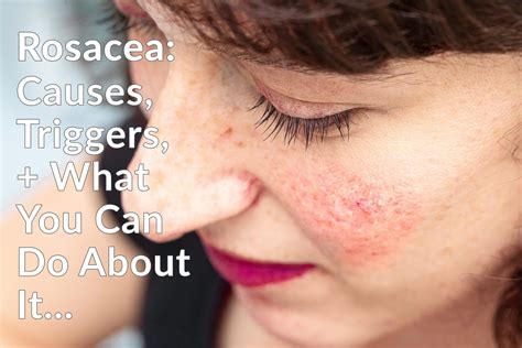 reddish face causes 5