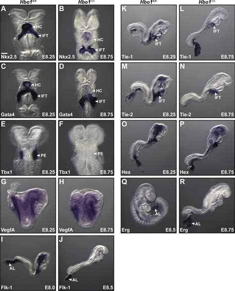 Whole Mount Rna In Situ Hybridization Detecting Mrna Purple Staining