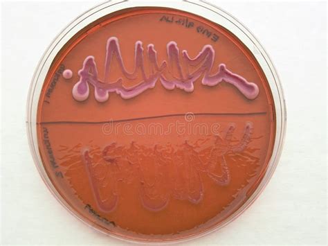 Bacterial Growth On Differential Agar Stock Image Image Of