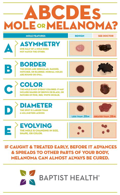 Melanoma Mole Benign