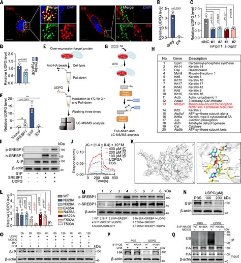 Hepatic Glycogenesis Antagonizes Lipogenesis By Blocking S P Via Udpg