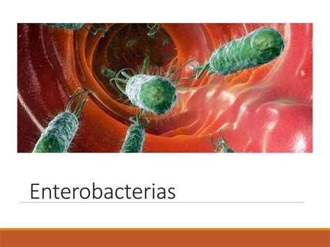 Enterobacterias Felisa Ivania Gomez Garcia Udocz