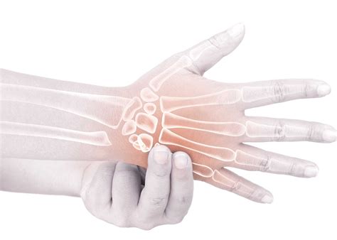 how to know if my hand is broken