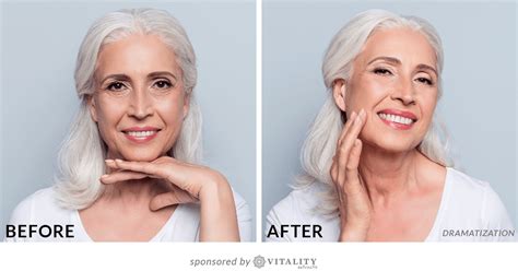 72 Year Old Reveals Her All Natural Anti Aging Secret Natural Anti