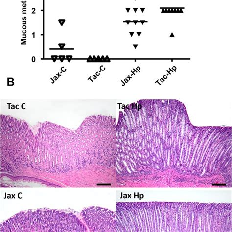 Expression Of Tff2 And Gsii Was Enhanced In The Gastric Corpus Of The