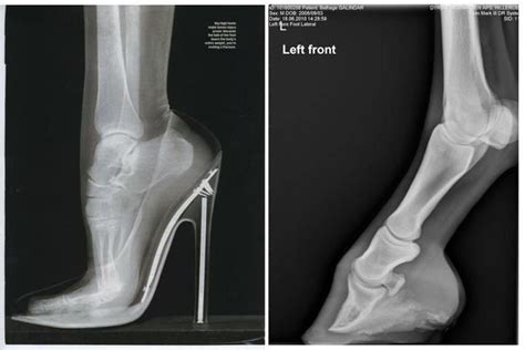 High Heel X-ray= Ouch! | Ballet shoes, Sport shoes, Dance shoes