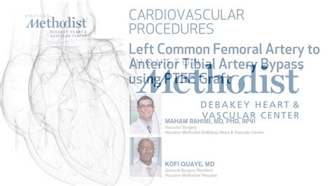 Femoral Bypass