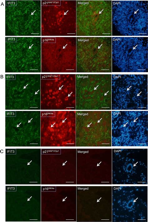 Association Of IFIT3 Expression With Senescent Markers P16INK4a In