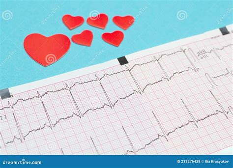 Elektrocardiografie Ecg Hart Ligt Op Het Cardiogram Zorg Voor De