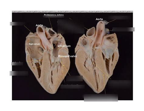 Sheep Heart Diagram | Quizlet
