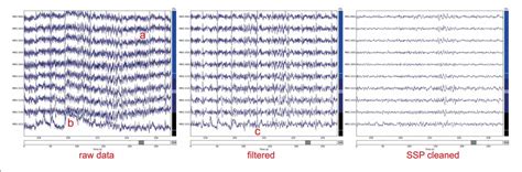 Figure From Meg And Eeg Data Analysis With Mne Python Semantic Scholar