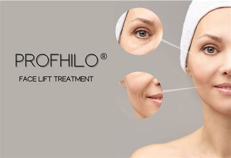 Profhilo O Novo Tratamento Para Rejuvenescimento Facial Cinthia F Del