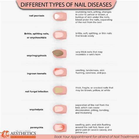 Skin And Nail Diseases - Dr Waris Anwar Aesthetics