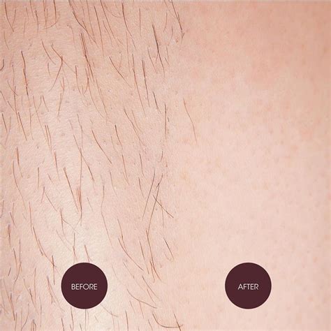 Buy Nad S Brazilian And Bikini Wax G Online At Chemist Warehouse