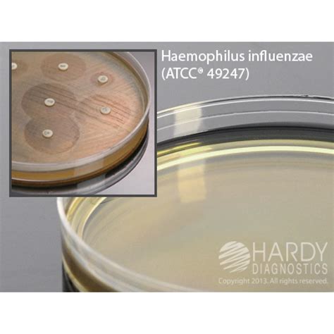 Hardy Diagnostic H07 Dry Culture Media Htm Agar Haemtest Med Plate