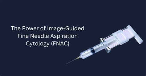 The Power Of Image Guided Fine Needle Aspiration Cytology