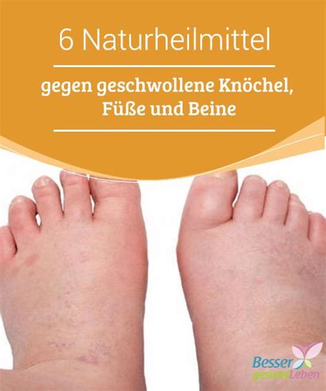 Geschwollene Knöchel und Füße 6 natürliche Hausmittel Besser Gesund