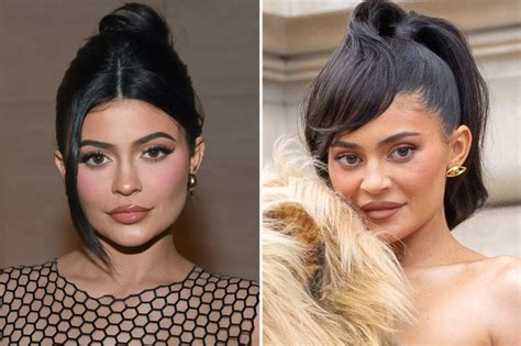 Kylie Jenner Fans Convinced Star Had Secret Procedure As They Catch Tell Tale Sign On Her Face