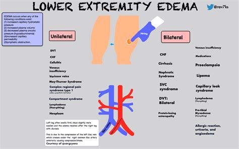 Peripheral Edema Grading