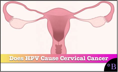 Is Cervical Cancer Caused by the HPV Virus? - Brightwork Research ...