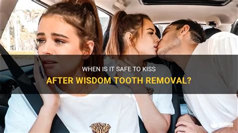 When Is It Safe To Kiss After Wisdom Tooth Removal Medshun