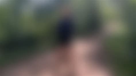 Leg Cast Sprained Ankle Porn Tube Video Clips Clips Sale