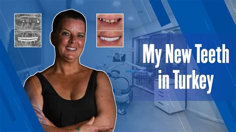 How To Get Your Teeth Done In Turkey Dentares Smile Clinic