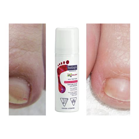 Footlogix Archives - Fernanda's Beauty & Spa Supplies