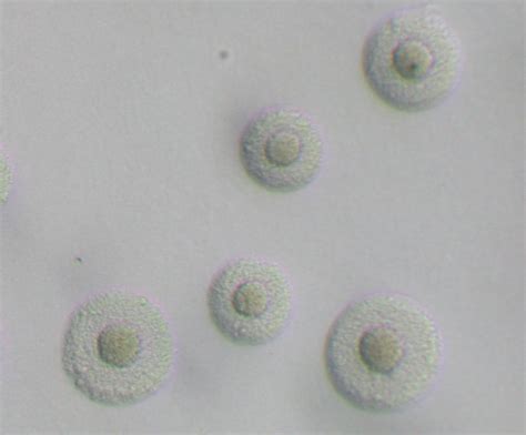 Mycoplasma Pneumoniae Fried Egg Appearance